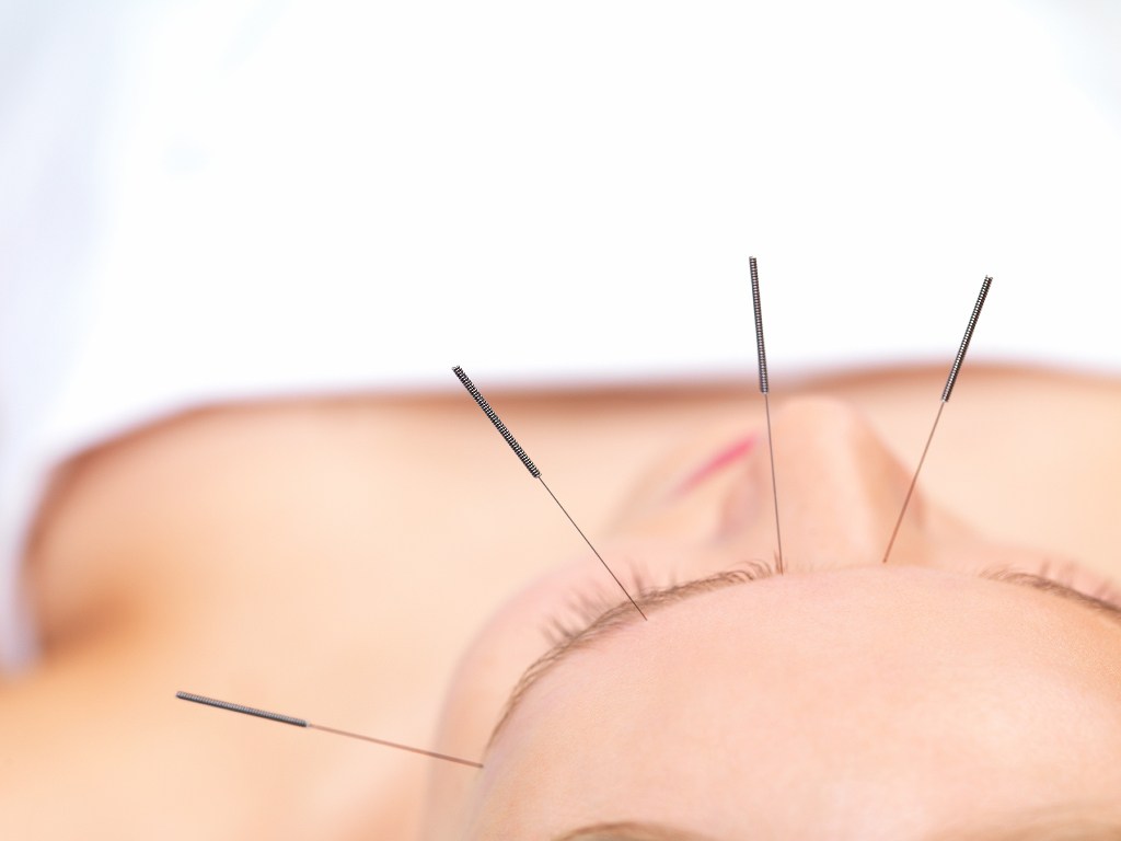 aaaaacupuncture-1_2